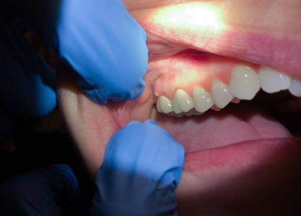Best Emergency Treatment for Jaw Pain or Injury in Wortham, TX