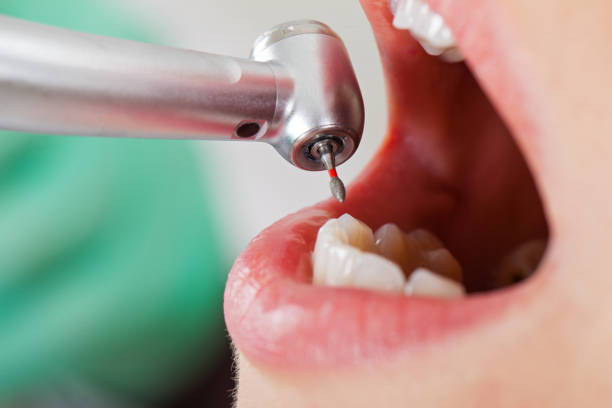 Best Urgent Dental Care for Toothaches in Wortham, TX